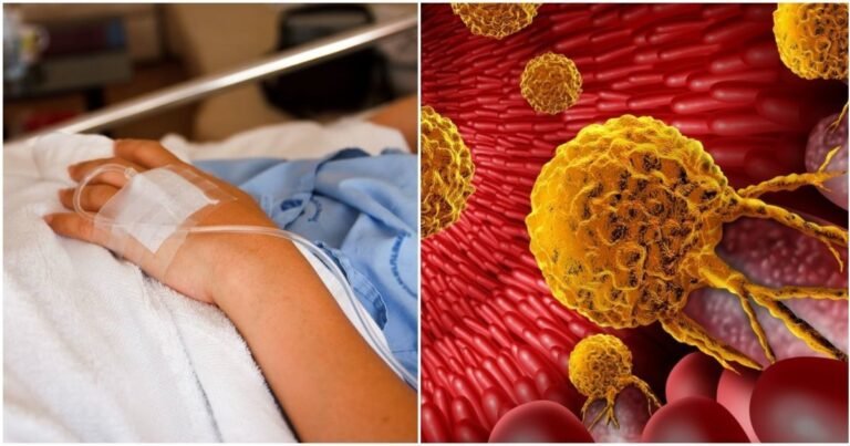 Daily Habits That Reduce Cancer Risk: Doctor Explains What Really Works