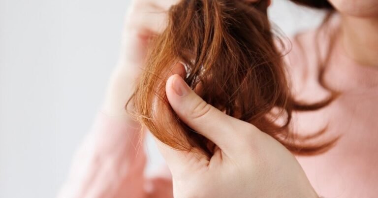 How to Get Rid of Oily Hair Naturally: Best Remedies for Fresh and Clean Hair